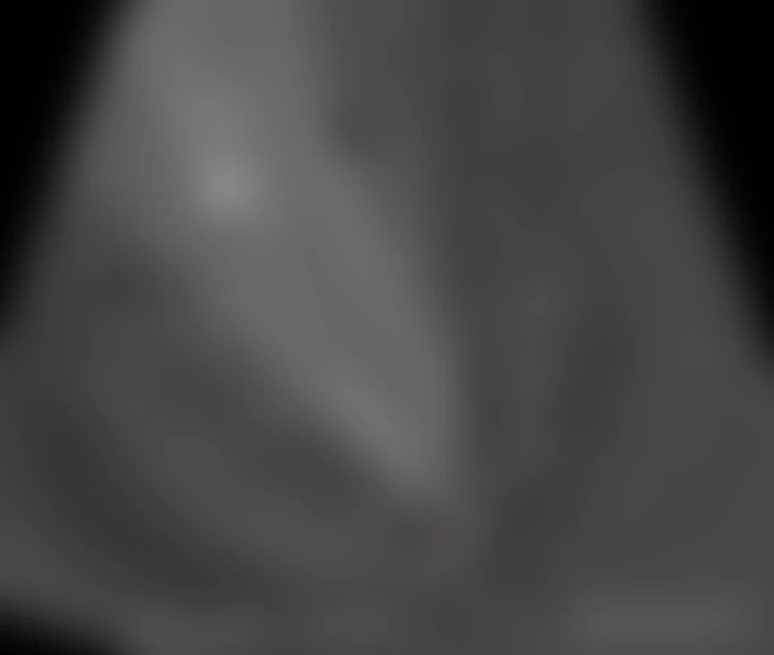 Image des structures autour du noyau de 12P/Pons-Brooks prise avec le télescope de 1m du pic du Midi